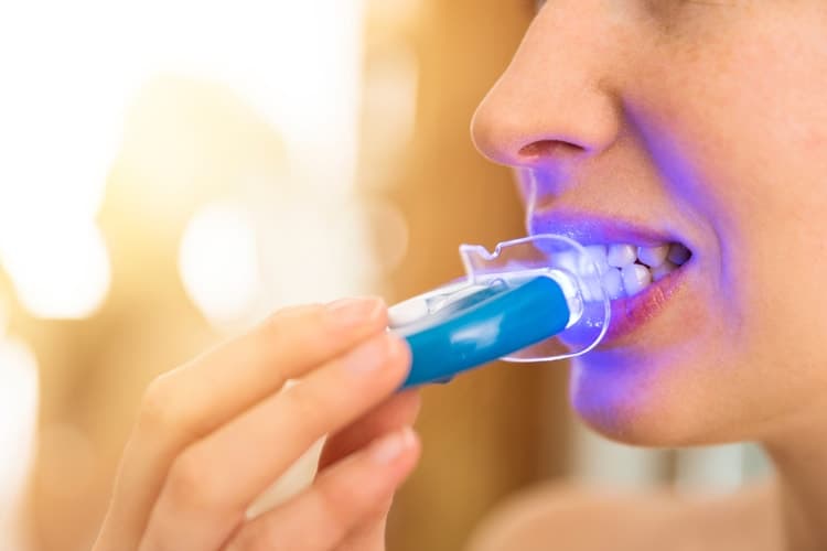 The 25 Best Teeth Whitening Kits In 2020 Smart Style Today