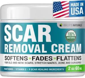 Kelly's Natural Scar Removal CreamKelly's Natural Scar Removal Cream